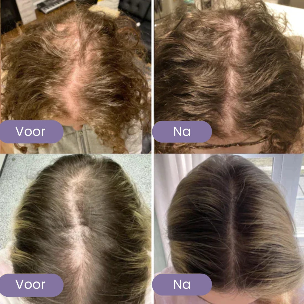 Natuurlijke Haargroei Olie