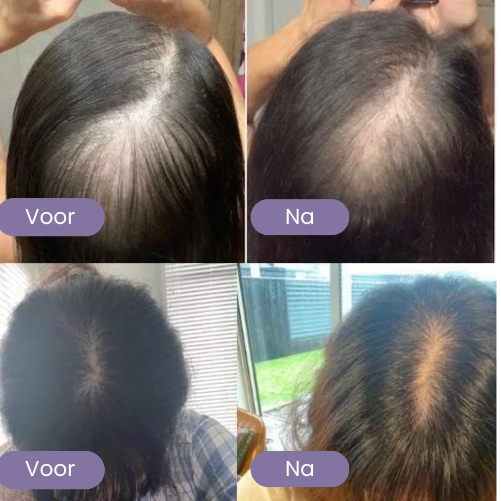 Natuurlijke Haargroei Olie