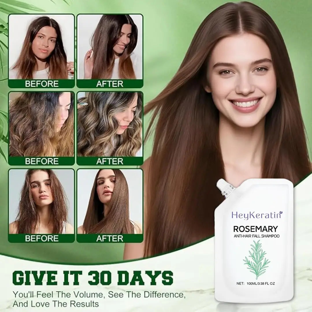 Rosemary Anti-Hair Fall Shampoo