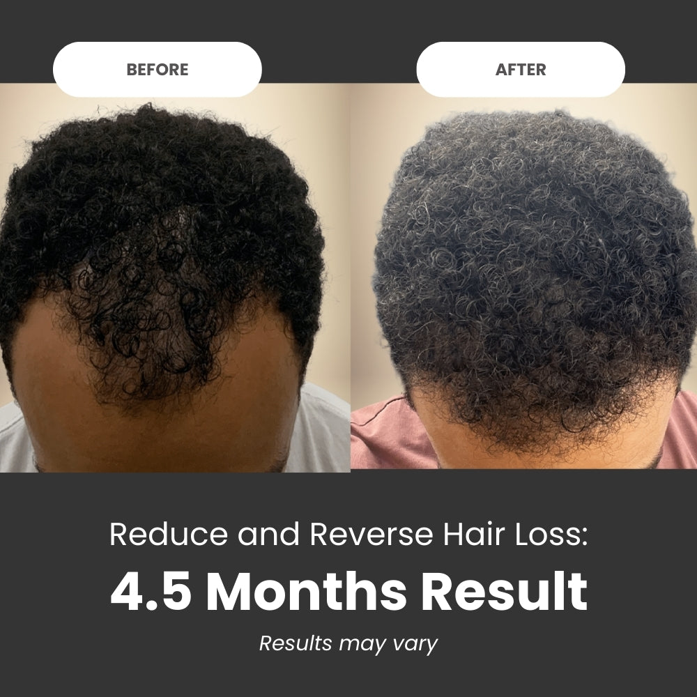 Organic Batana Natural Growth Oil