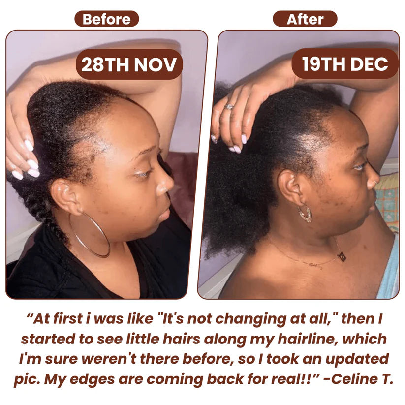 Batana Organic Growth Oil