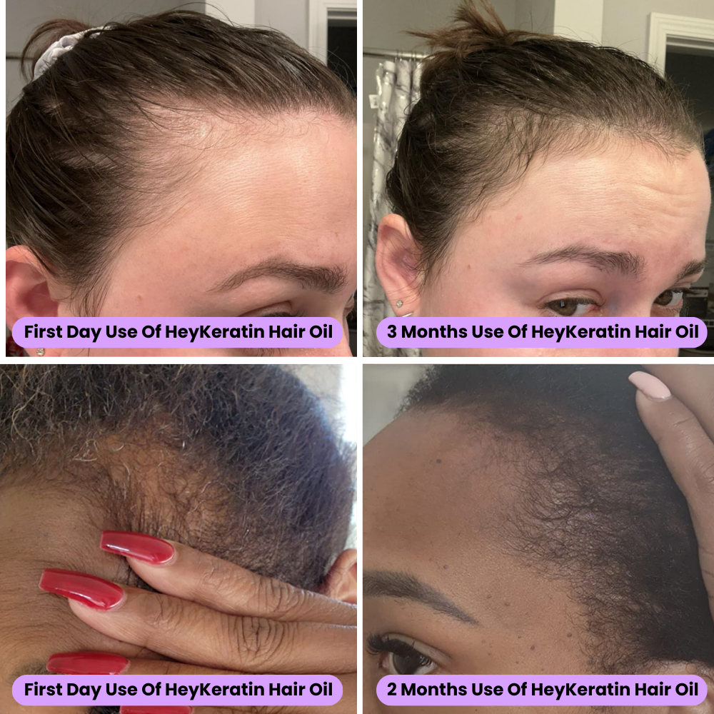 Batana Natural Organic Growth Oil HeyKeratin batana-natural-organic-growth-oil-heykeratin