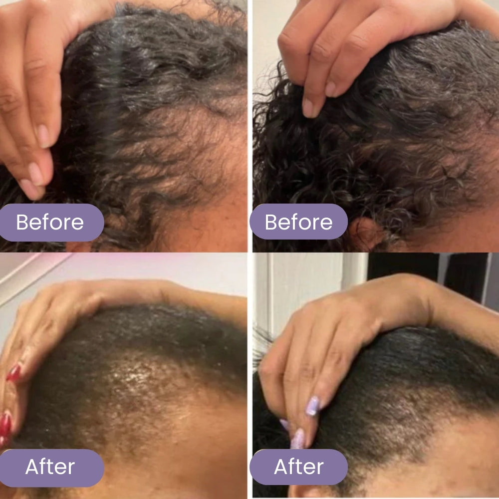 Natural Hair Growth Serum 2.0