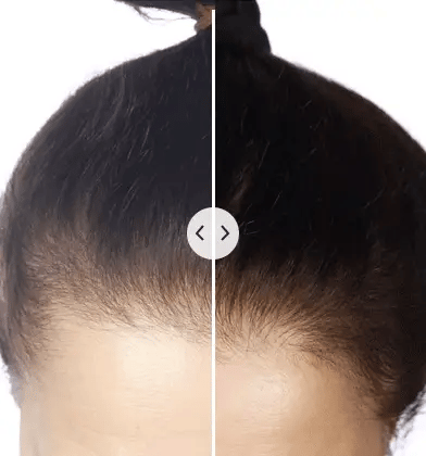Hair Rejuvenator Brush PRO – HeyKeratin