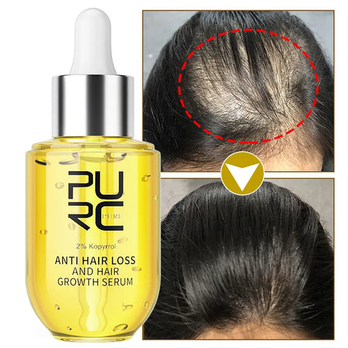 PURE Hair Growth Anti-hair Loss