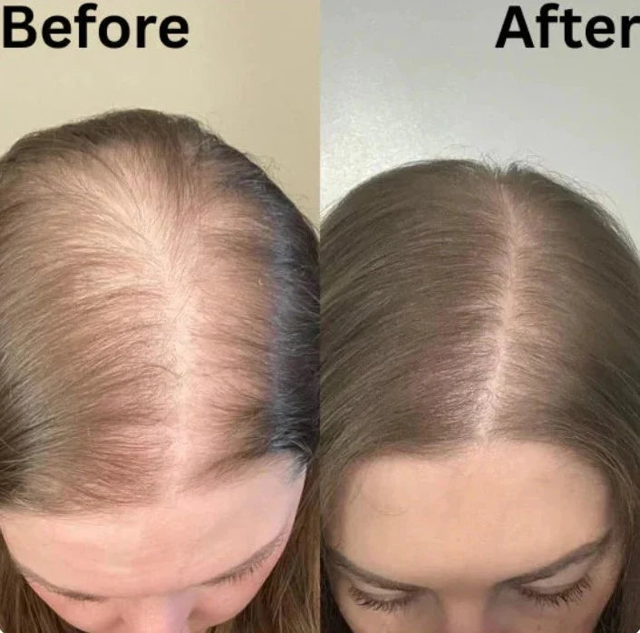 Rachel D. before and after