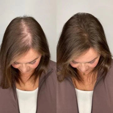 Linda M. before and after